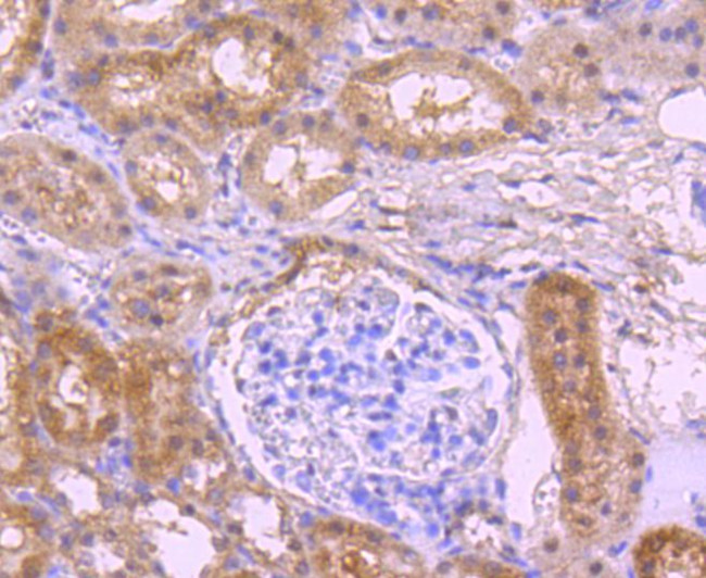 NOX4 Antibody in Immunohistochemistry (Paraffin) (IHC (P))