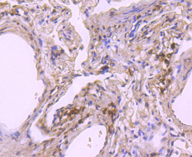 NOX4 Antibody in Immunohistochemistry (Paraffin) (IHC (P))