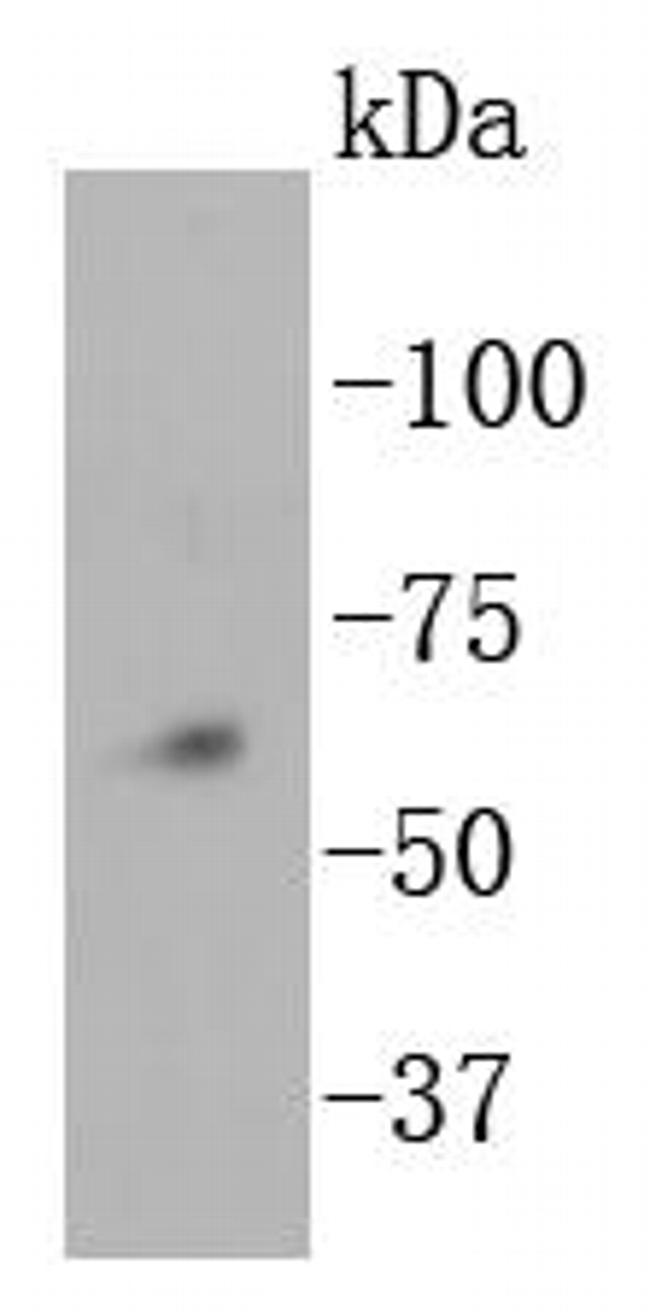 NOX4 Antibody in Western Blot (WB)