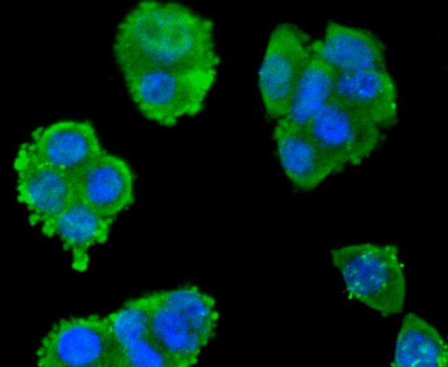 SMAD3 Antibody in Immunocytochemistry (ICC/IF)