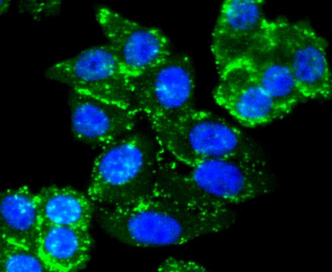 SMAD3 Antibody in Immunocytochemistry (ICC/IF)