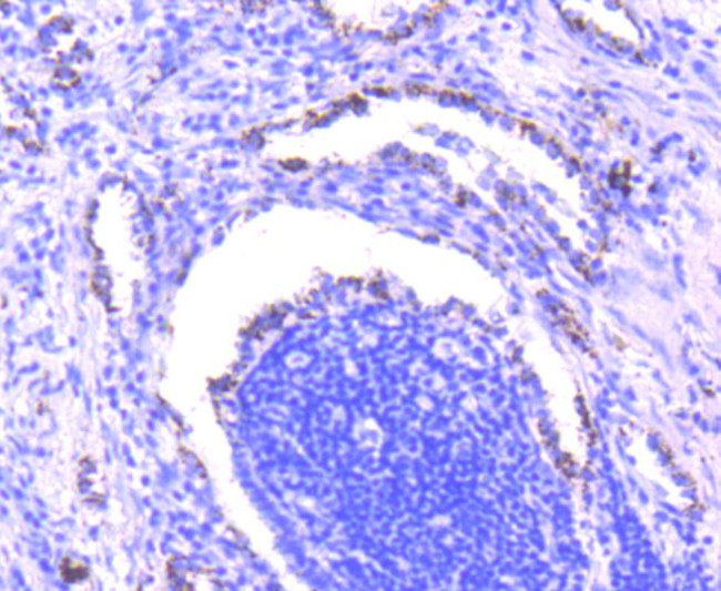 SMAD3 Antibody in Immunohistochemistry (Paraffin) (IHC (P))