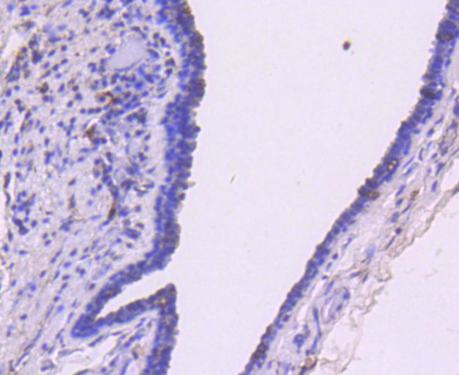 SMAD3 Antibody in Immunohistochemistry (Paraffin) (IHC (P))