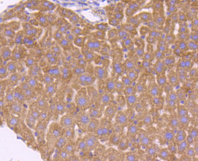 SMAD3 Antibody in Immunohistochemistry (Paraffin) (IHC (P))