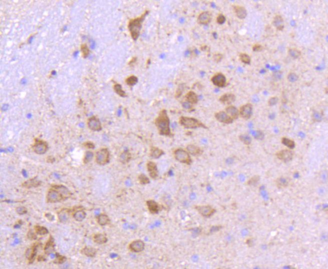 SMAD3 Antibody in Immunohistochemistry (Paraffin) (IHC (P))