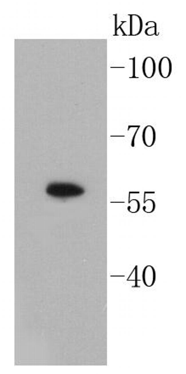 SMAD3 Antibody in Western Blot (WB)