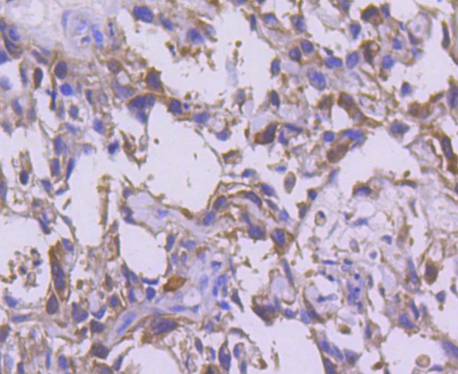 CDK1 Antibody in Immunohistochemistry (Paraffin) (IHC (P))