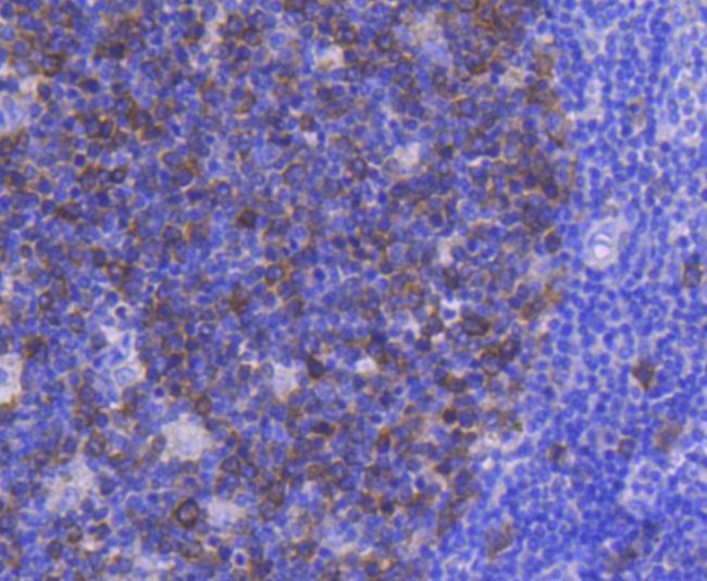 CDK1 Antibody in Immunohistochemistry (Paraffin) (IHC (P))