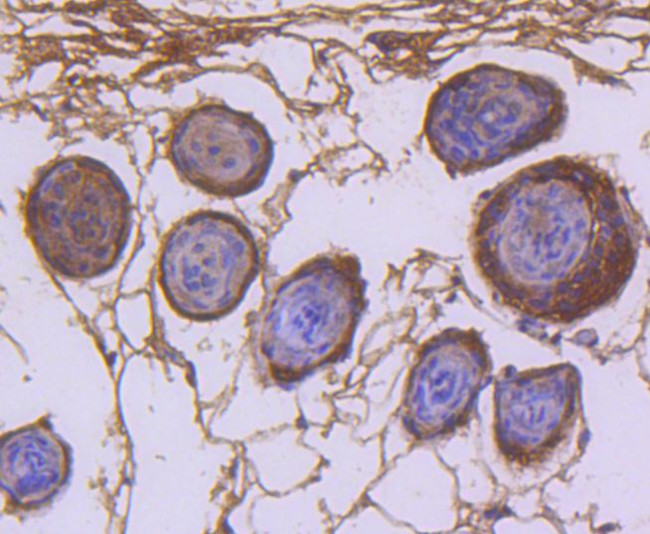 CDK1 Antibody in Immunohistochemistry (Paraffin) (IHC (P))