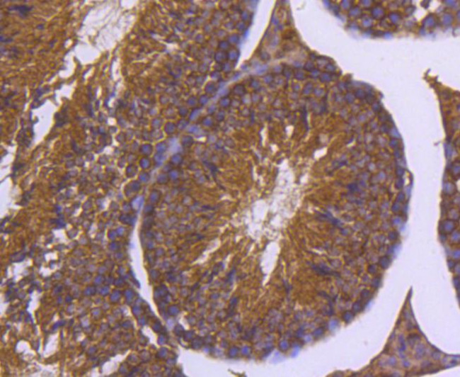 DNAJC15 Antibody in Immunohistochemistry (Paraffin) (IHC (P))