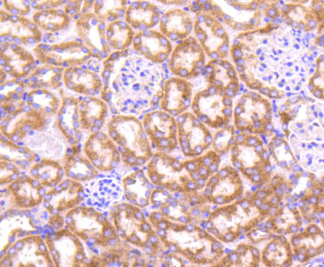 TOP2A Antibody in Immunohistochemistry (Paraffin) (IHC (P))