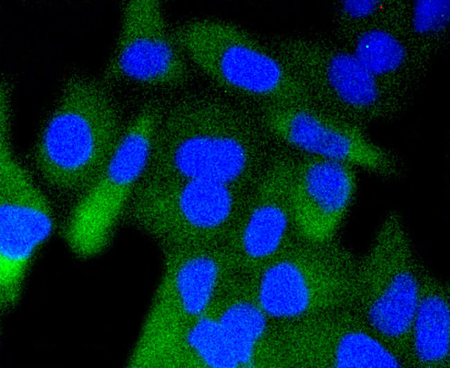 Phospho-GSK3B (Ser9) Antibody in Immunocytochemistry (ICC/IF)