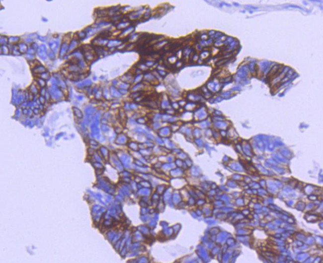 Phospho-GSK3B (Ser9) Antibody in Immunohistochemistry (Paraffin) (IHC (P))