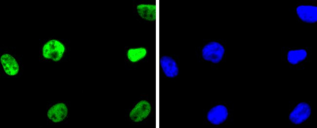 HDAC2 Antibody in Immunocytochemistry (ICC/IF)