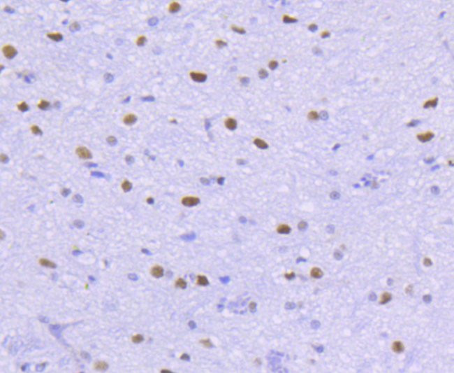 HDAC2 Antibody in Immunohistochemistry (Paraffin) (IHC (P))