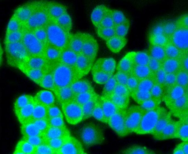 PKC alpha Antibody in Immunocytochemistry (ICC/IF)