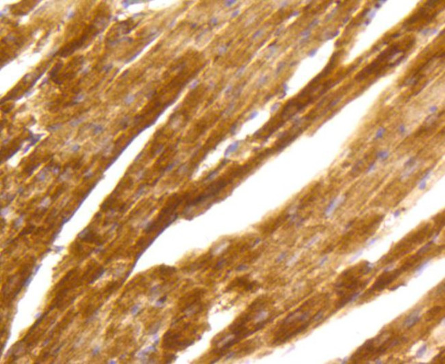 PKC alpha Antibody in Immunohistochemistry (Paraffin) (IHC (P))