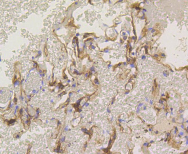 PKC alpha Antibody in Immunohistochemistry (Paraffin) (IHC (P))