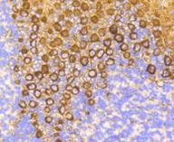 PKC alpha Antibody in Immunohistochemistry (Paraffin) (IHC (P))