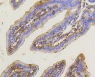 PKC alpha Antibody in Immunohistochemistry (Paraffin) (IHC (P))