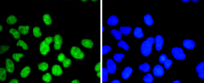 ELK1 Antibody in Immunocytochemistry (ICC/IF)