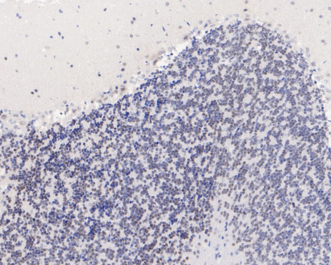 ELK1 Antibody in Immunohistochemistry (Paraffin) (IHC (P))