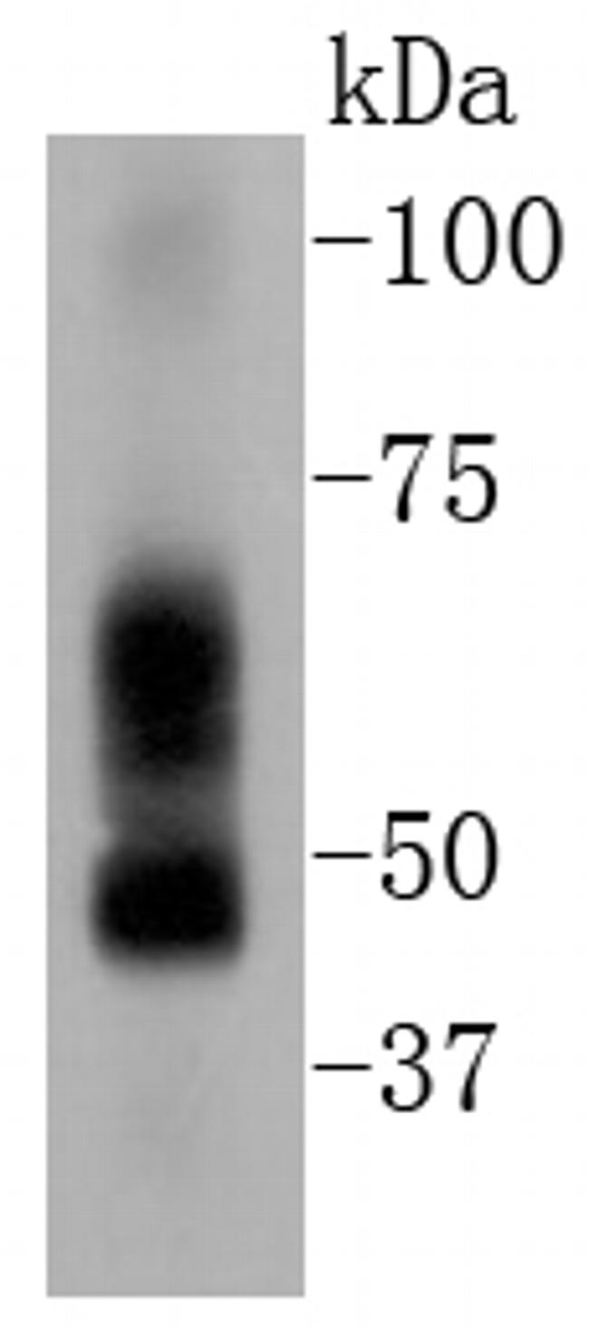 ELK1 Antibody in Western Blot (WB)