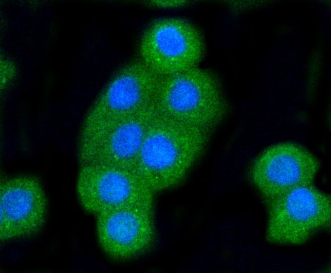 BAK Antibody in Immunocytochemistry (ICC/IF)