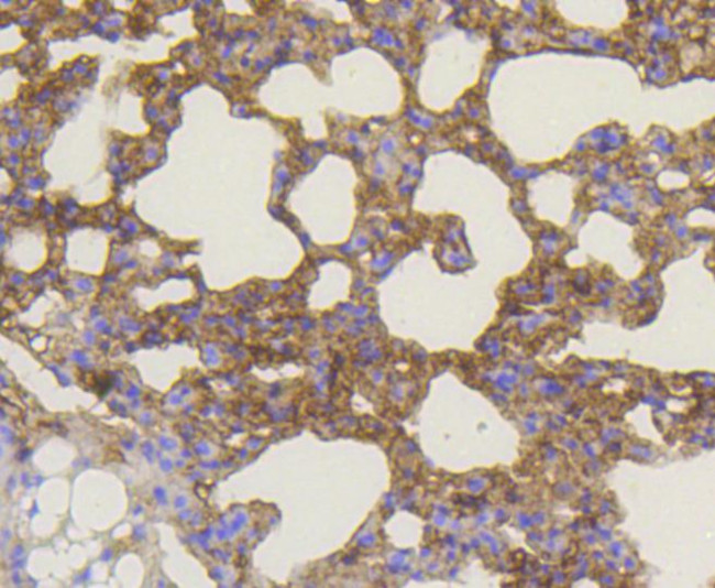 BAK Antibody in Immunohistochemistry (Paraffin) (IHC (P))