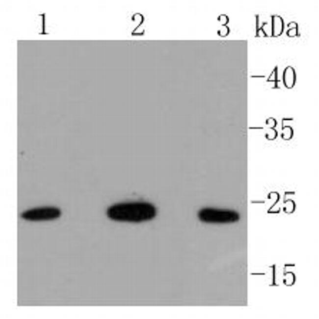 BAK Antibody in Western Blot (WB)