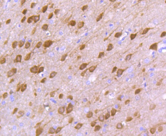 DARPP-32 Antibody in Immunohistochemistry (Paraffin) (IHC (P))