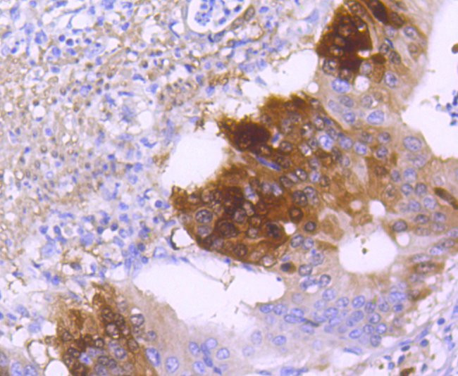 DARPP-32 Antibody in Immunohistochemistry (Paraffin) (IHC (P))