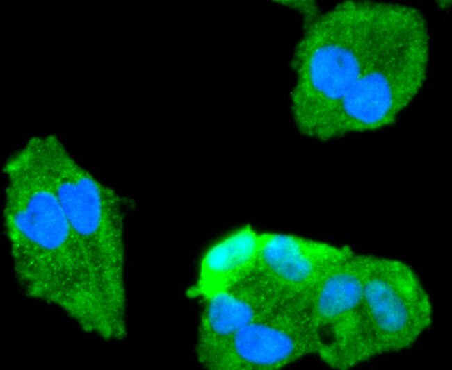 FOXO1 Antibody in Immunocytochemistry (ICC/IF)