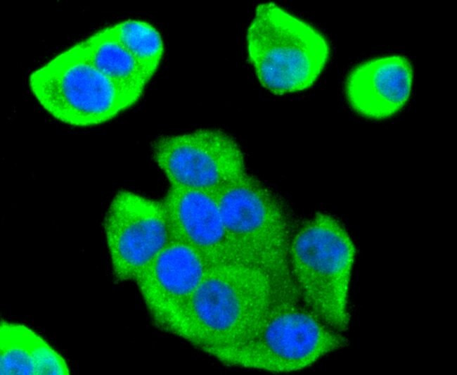 FOXO1 Antibody in Immunocytochemistry (ICC/IF)