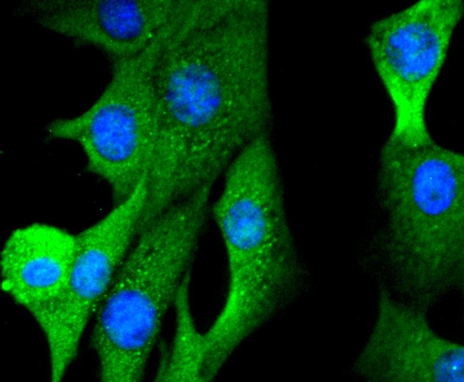 FOXO1 Antibody in Immunocytochemistry (ICC/IF)