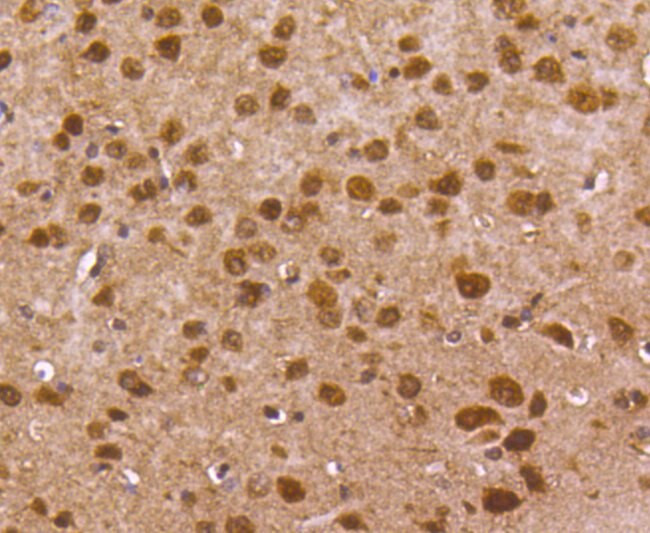 FOXO1 Antibody in Immunohistochemistry (Paraffin) (IHC (P))