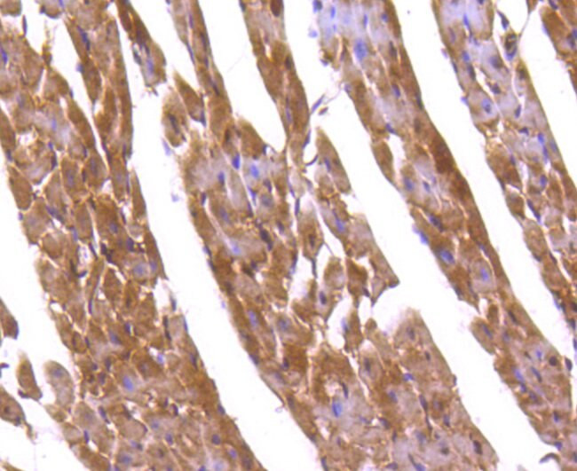 FOXO1 Antibody in Immunohistochemistry (Paraffin) (IHC (P))