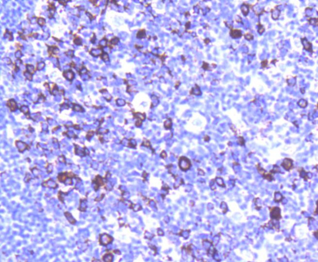 Cyclin B1 Antibody in Immunohistochemistry (Paraffin) (IHC (P))