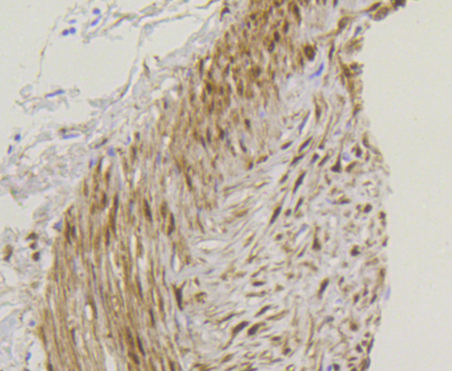 YAP1 Antibody in Immunohistochemistry (Paraffin) (IHC (P))