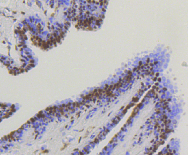 YAP1 Antibody in Immunohistochemistry (Paraffin) (IHC (P))