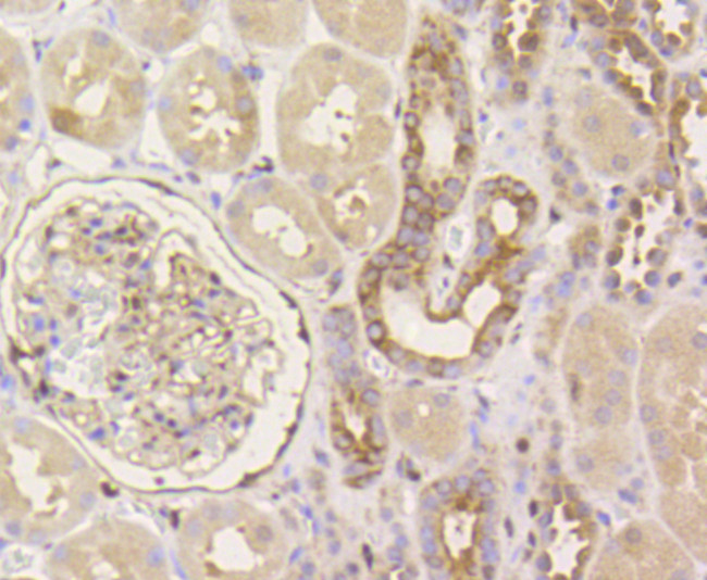 YAP1 Antibody in Immunohistochemistry (Paraffin) (IHC (P))