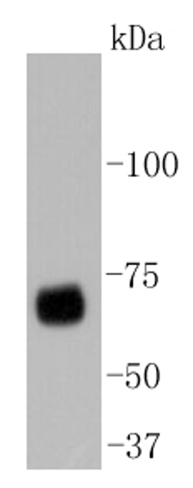 YAP1 Antibody in Western Blot (WB)