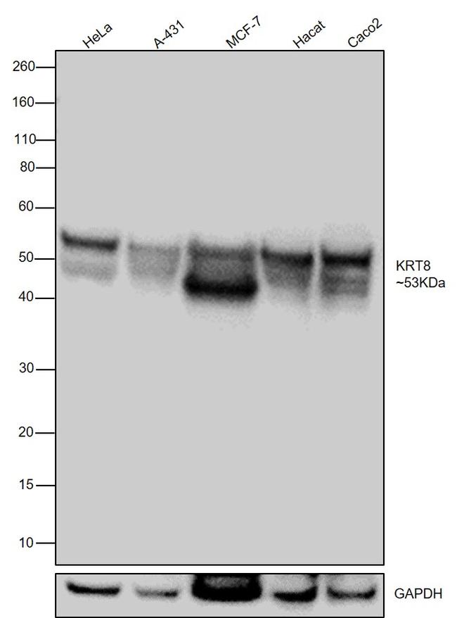 Cytokeratin 8 Antibody in Western Blot (WB)