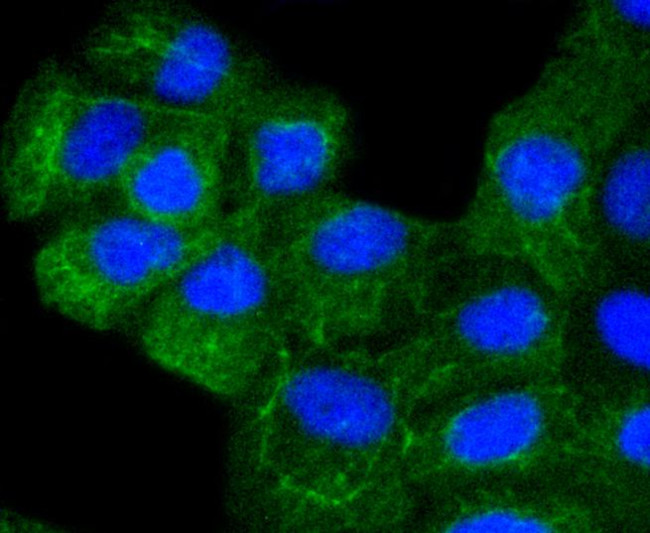 Cytokeratin 8 Antibody in Immunocytochemistry (ICC/IF)