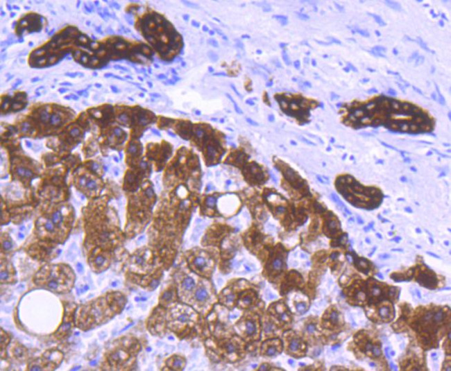 Cytokeratin 8 Antibody in Immunohistochemistry (Paraffin) (IHC (P))