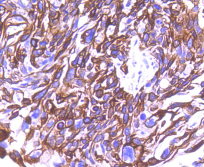 Cytokeratin 8 Antibody in Immunohistochemistry (Paraffin) (IHC (P))