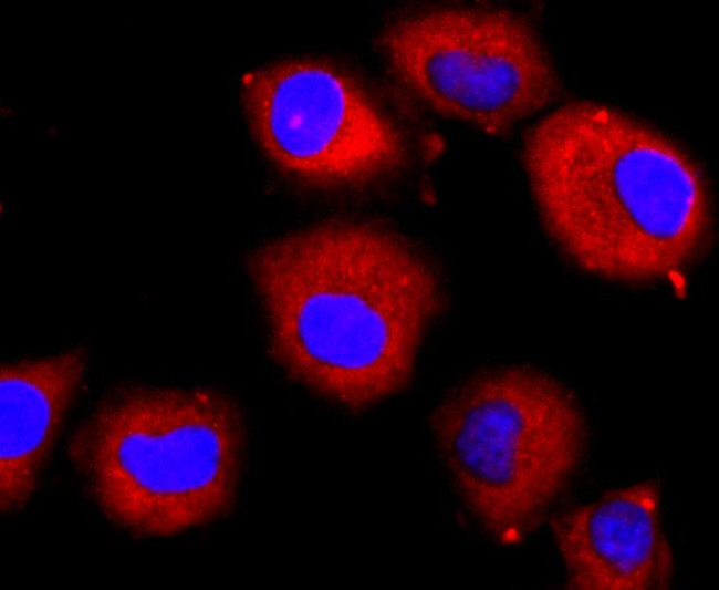 CD309 (FLK1) Antibody in Immunocytochemistry (ICC/IF)