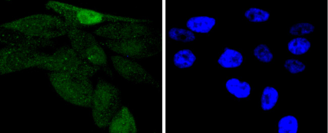 Phospho-c-Jun (Ser63) Antibody in Immunocytochemistry (ICC/IF)