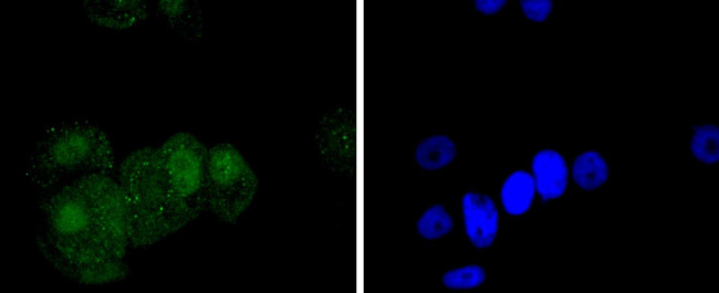 Phospho-c-Jun (Ser63) Antibody in Immunocytochemistry (ICC/IF)