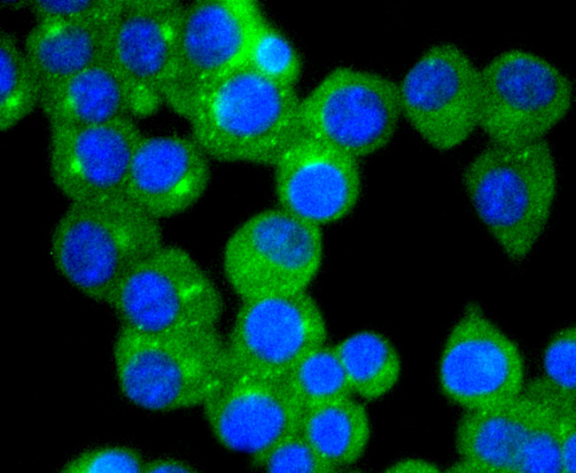 TrkA Antibody in Immunocytochemistry (ICC/IF)